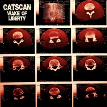 CATSCAN